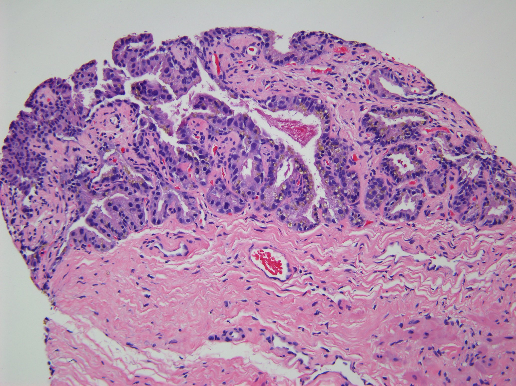 View Slide